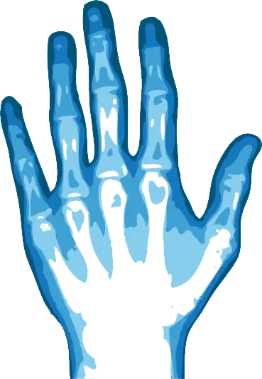 أشعة